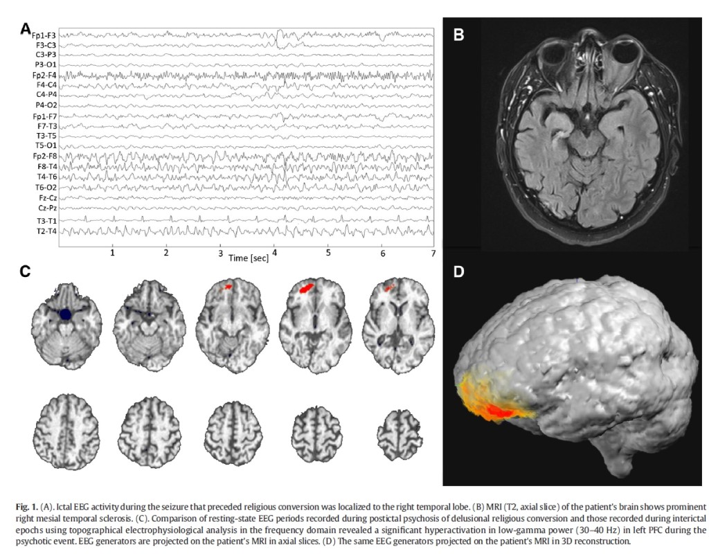 God on the Brain. From Arzy and Schurr, 2016